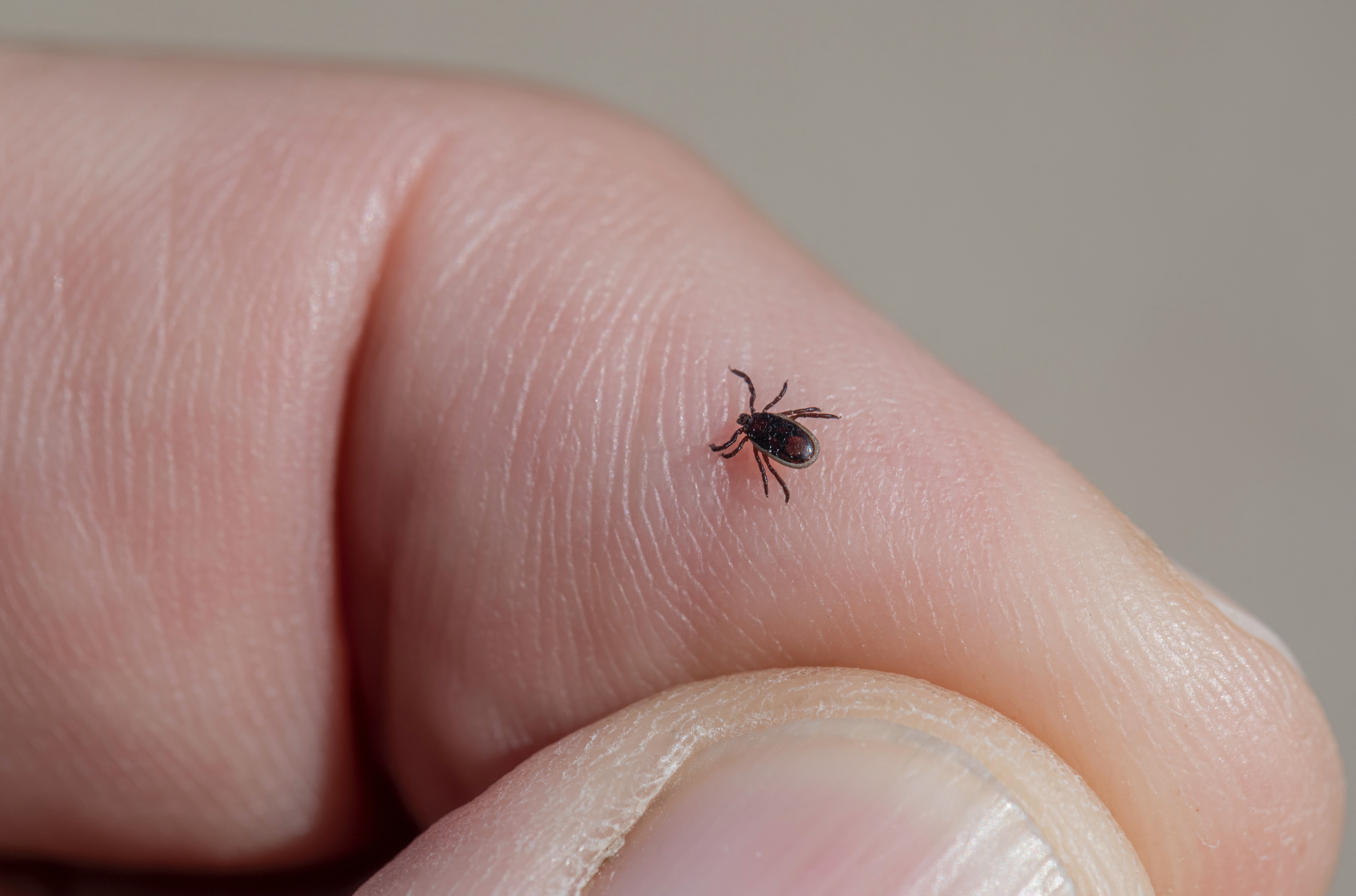 The Importance Of Checking Ticks
